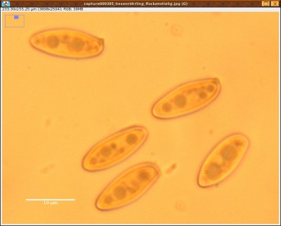 Sporen Flockenstieliger Hexenröhrling